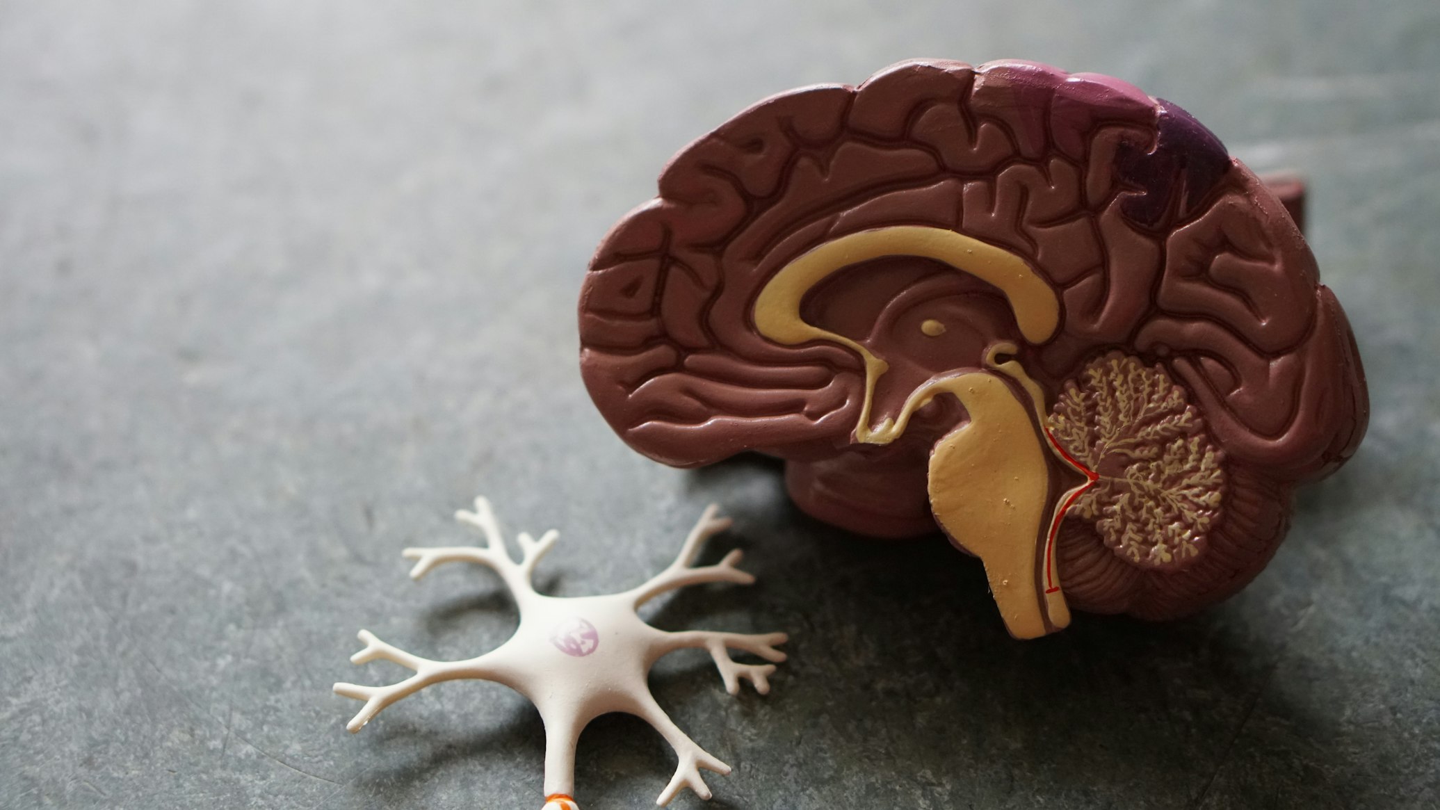 fMRI scan visualization